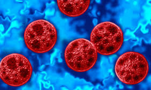 Cyclosporiasis outbreak claims 2 lives in US
